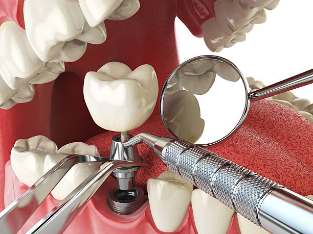 Best Orthodontic Emergency Dentist in Carrollton, OH